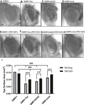 DYRK1a Inhibitor Mediated Rescue of Drosophila Models of Alzheimer’s Disease-Down Syndrome Phenotypes